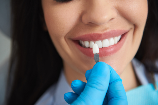 How To Care for Dental Veneers - Burba Dental Partners Salem Massachusetts